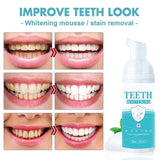 Teeth Whitening Foam